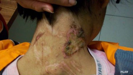La nueva vida de la esclava de la tintotería que conmocionó a México