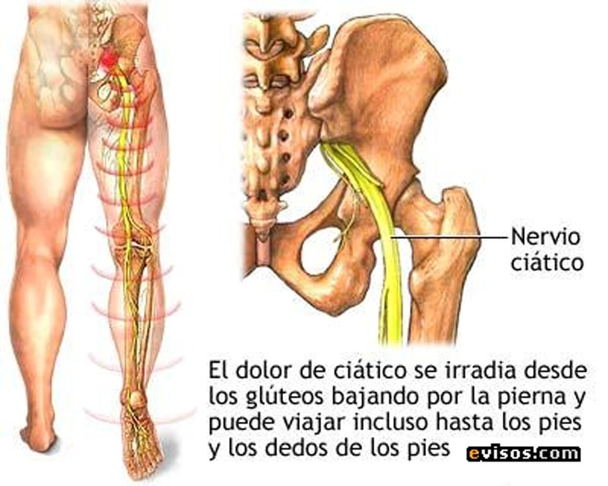 dolor en la pierna izquierda y cadera