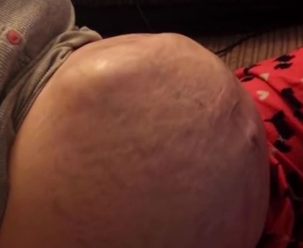 Impresionante video de bebé a punto de nacer