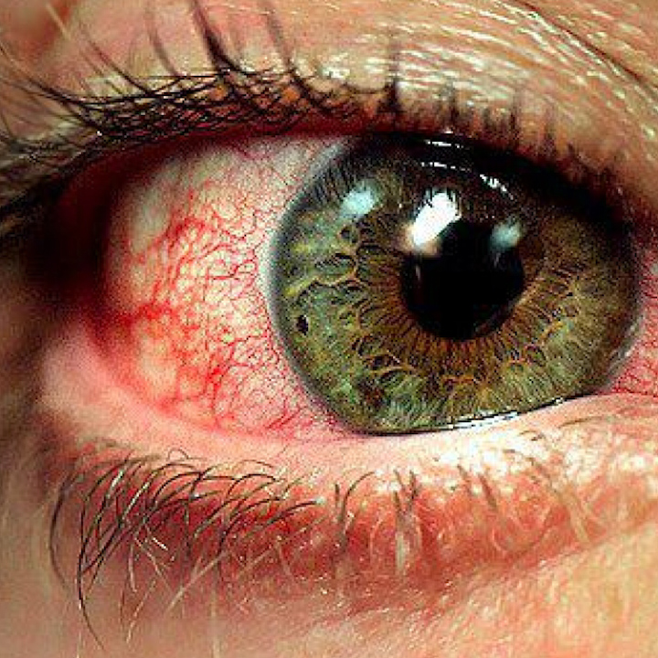¿Sabes por qué la marihuana te deja los ojos rojos?