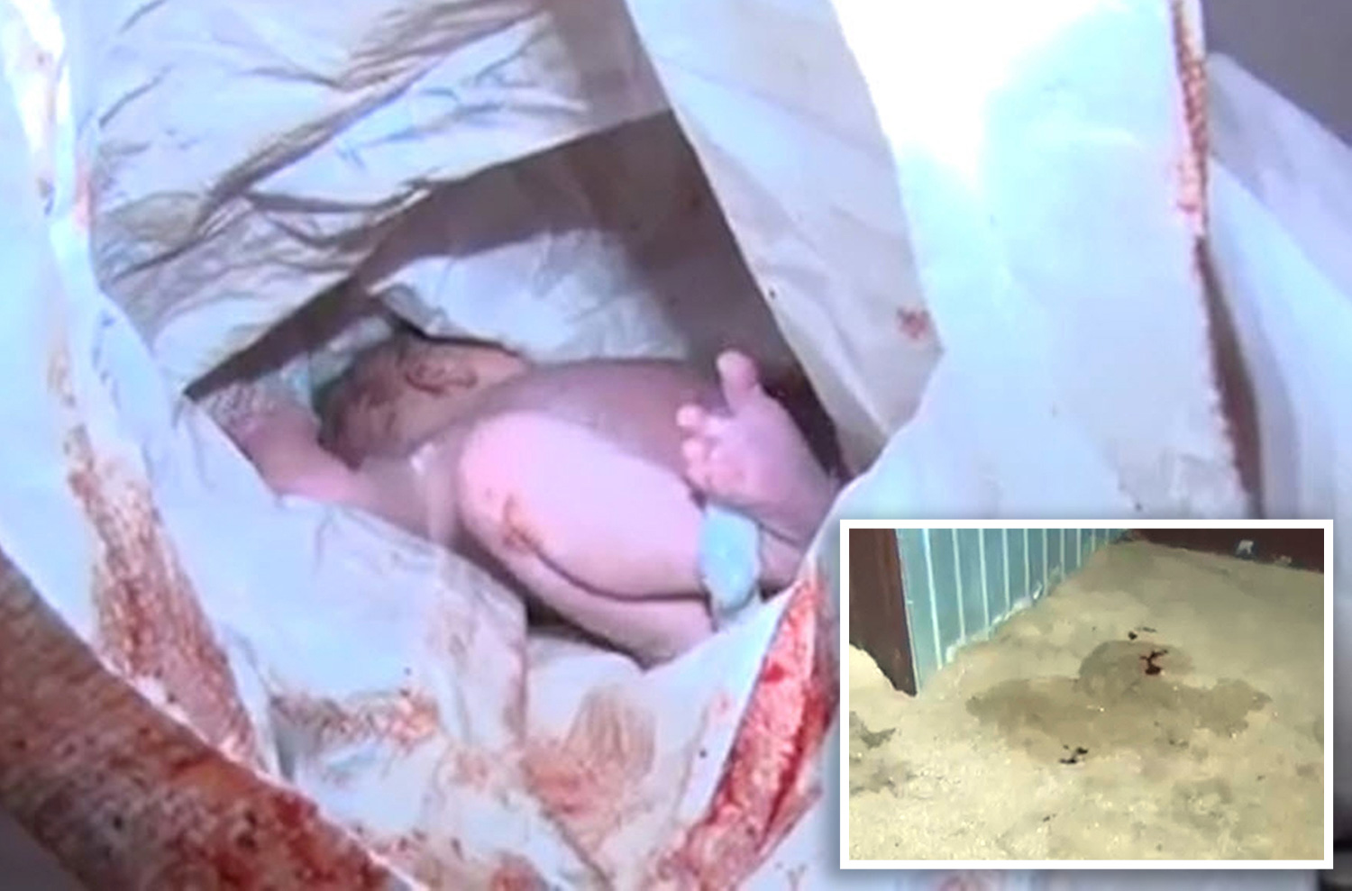 Rescatan a bebé recién nacida del pozo séptico de un baño rural