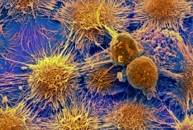 El secreto para curar el cáncer podría estar en el sistema inmune de personas que resisten a los tumores