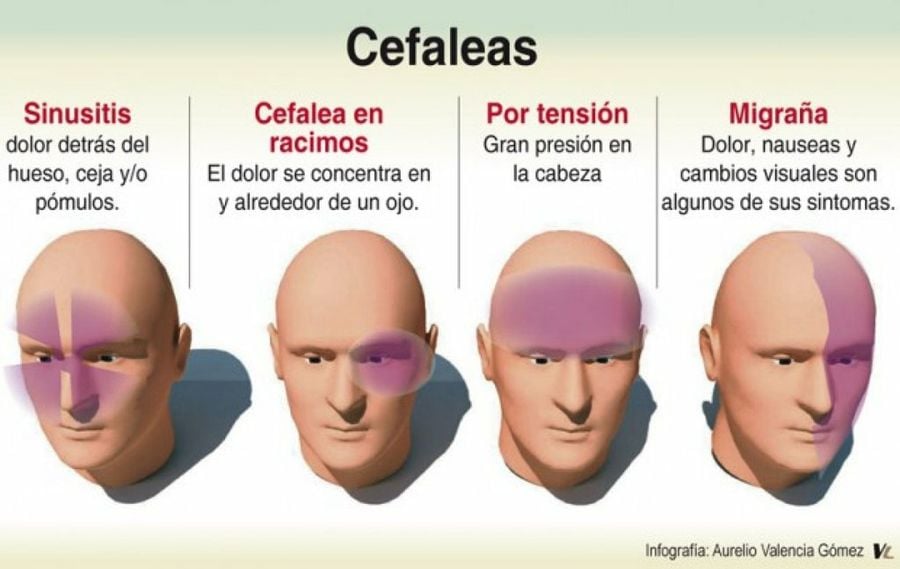 ¿Conoces las diferencias entre Cefalea Tensional y Migrañas?