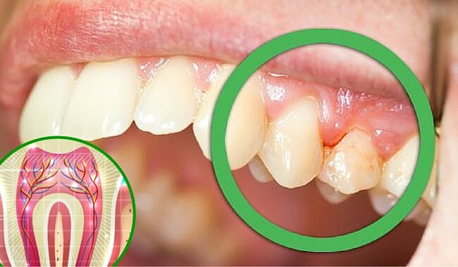 6 causas comunes del dolor en los dientes
