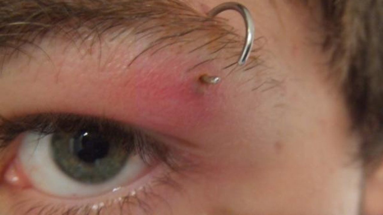 Para desinfectar un piercing en la oreja