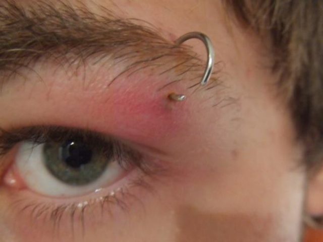 como curar infeccion piercing labio como curar infeccion piercing labio