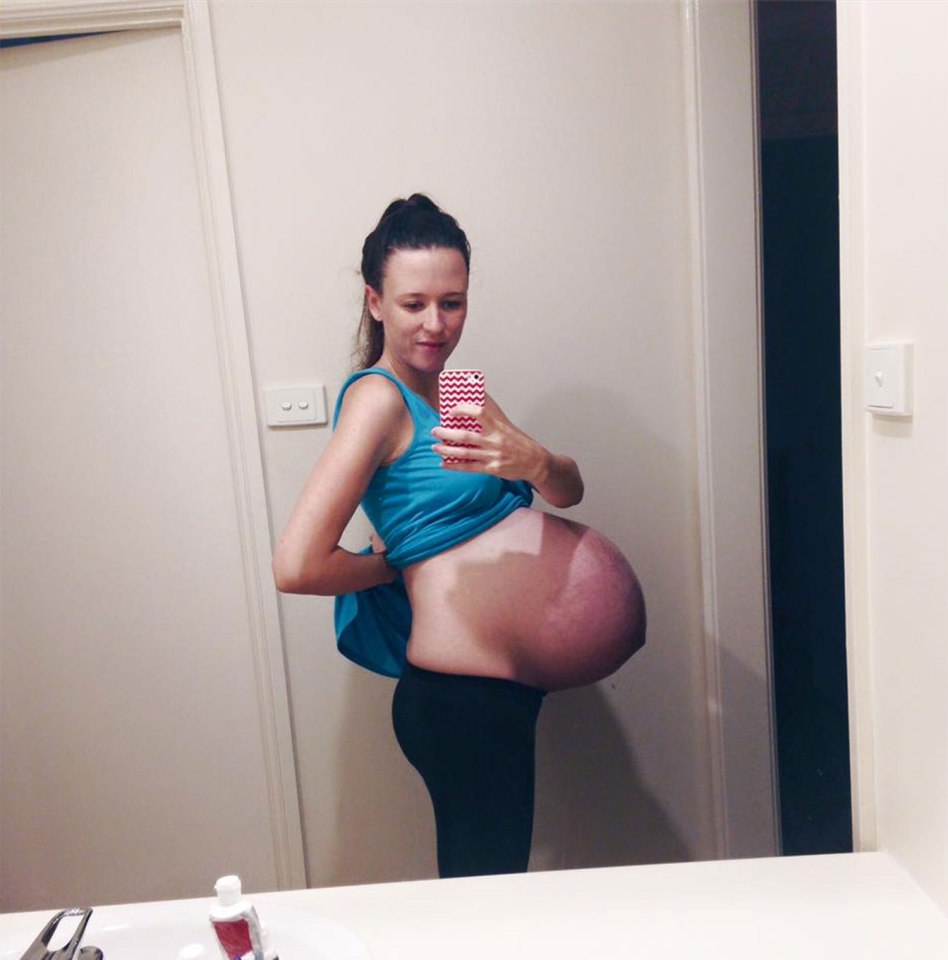 Publicó foto de su embarazo y pervertidos la subieron a página porno de embarazadas