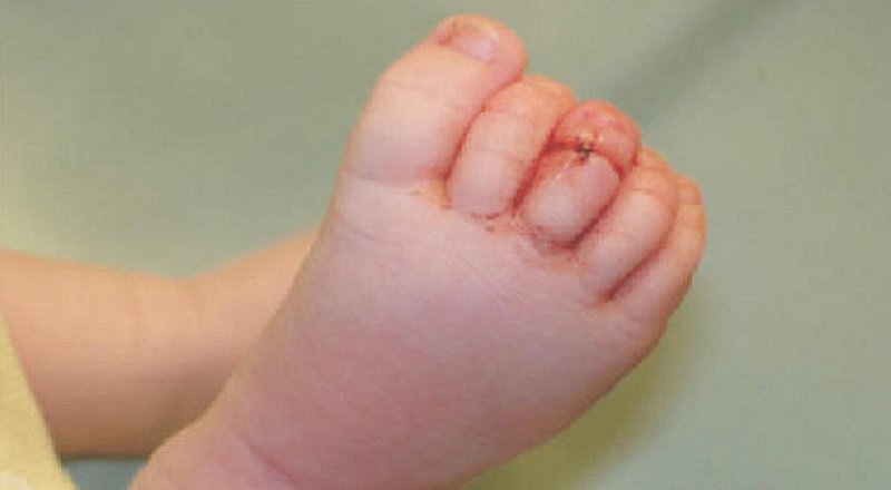 Bebé no paraba de llorar hasta que le quitaron los calcetines y encontraron esto…