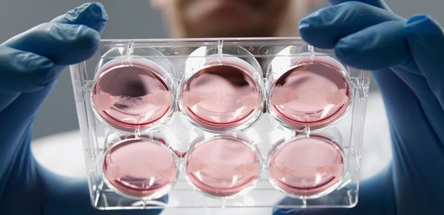 Aumentan tratamientos ilegales con células madre en Estados Unidos