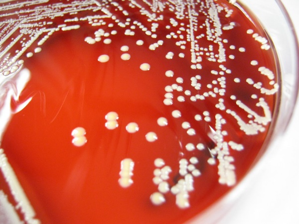 Nuevo antibiótico descubierto en la nariz humana es capaz de atacar superbacterias