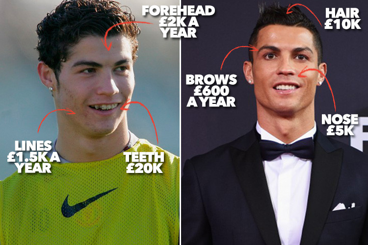 Mira aquí el antes y el después de Cristiano Ronaldo tras someterse a cirugías estéticas