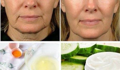 5 remedios caseros para combatir la flacidez facial