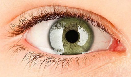 6 remedios caseros para aliviar ese molesto lagrimeo de ojos
