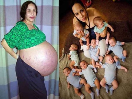 Ella tuvo octillizos y fue noticia mundial. Después de la fama, su vida es totalmente diferente: así lucen hoy