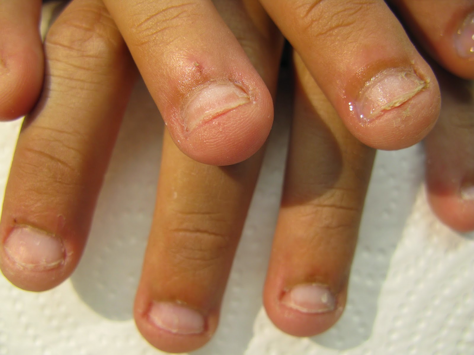 Estos son los riesgos de morderte las uñas y cómo superar este mal hábito