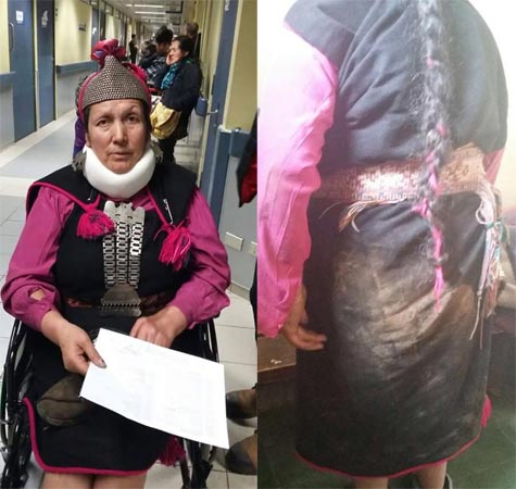 No hay respeto: Líder mapuche Juana Calfunao, quien encaró a Bachelet por Ley Antiterrorista, fue golpeada por Carabineros