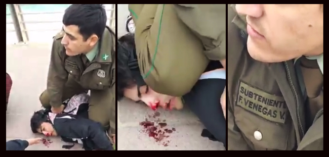 Otra vez la violencia policial: Carabinero dejó sangrando a joven detenido por hacer un graffiti