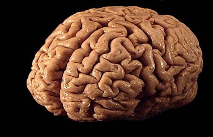 Investigadores miden los cambios en los pliegues del cerebro a lo largo de la vida