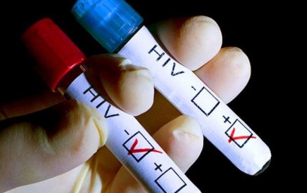Ministerio de Salud evalúa permitir venta de test rápidos de VIH en farmacias