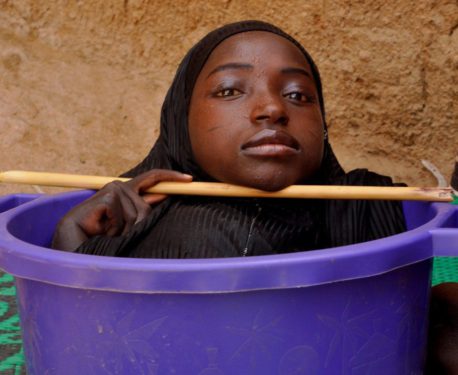 Rahma Haruna, la adolescente que vivía en un recipiente plástico, acaba de morir