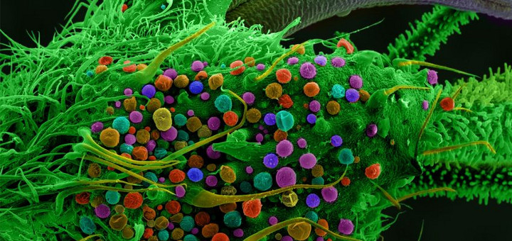 Así se ve la planta de marihuana bajo el microscopio