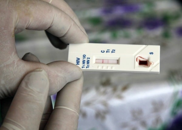 Tecnólogos Médicos proponen que kit para detectar VIH sea vendido libremente en farmacias