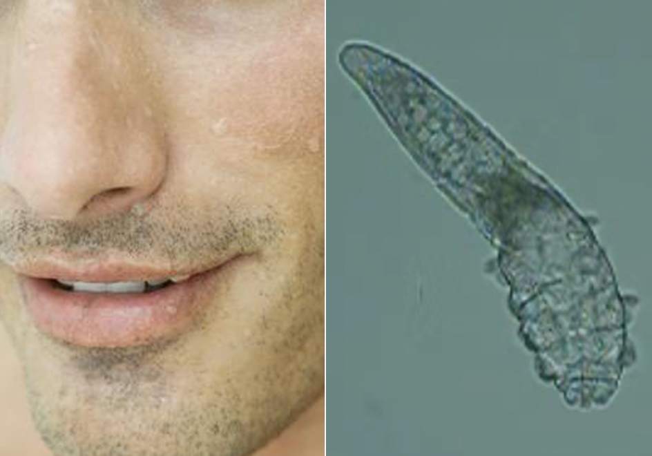 Insectos que viven y se reproducen en nuestro rostro desde hace miles de años