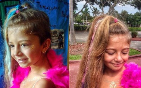 Conoce a la niña nació con el corazón fuera del cuerpo