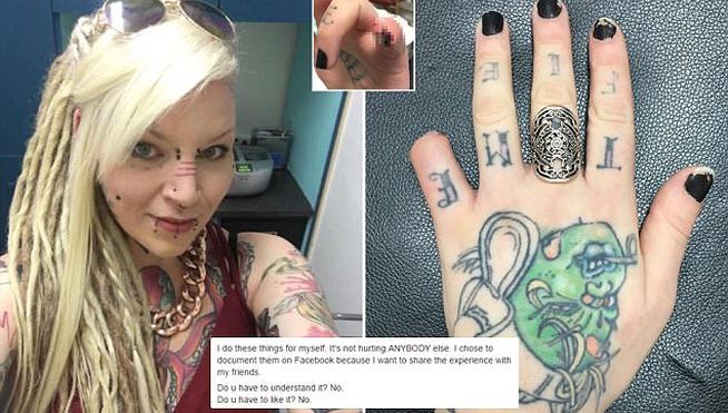 Facebook: Conmoción causa mujer que se autoamputó el dedo meñique y lo mostró en las redes (+Fotos)