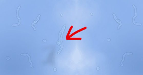¿Qué son esas manchitas transparentes que flotan en nuestro campo visual? Acá te contamos