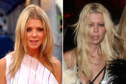 7 Fotos impactantes de celebridades antes y después de las drogas