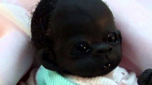 ¿Recuerdas al bebé más negro del mundo? No podrás creer cómo luce HOY