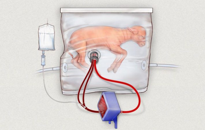 Crean útero artificial que podría salvar las vidas de bebés prematuros
