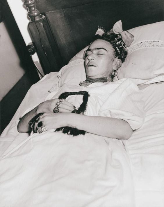 Fotografías de los peores años en la vida de Frida Khalo