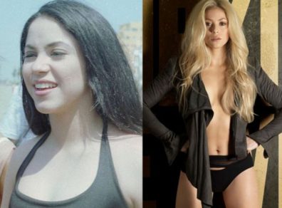 A estas operaciones se habría sometido Shakira para obtener su figura actual