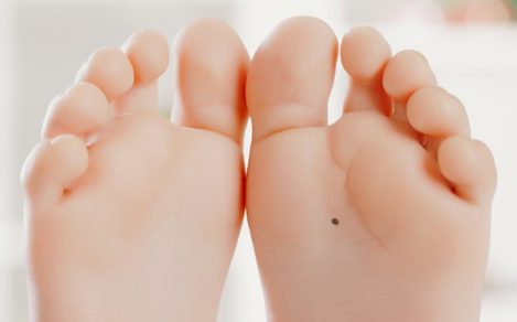 Descubre cuál es el significado de los lunares en nuestro cuerpo