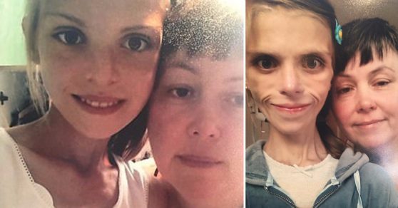 «Lo intenté, pero la anorexia me ganó»: La dura carta de una joven que se quitó la vida con 15 años