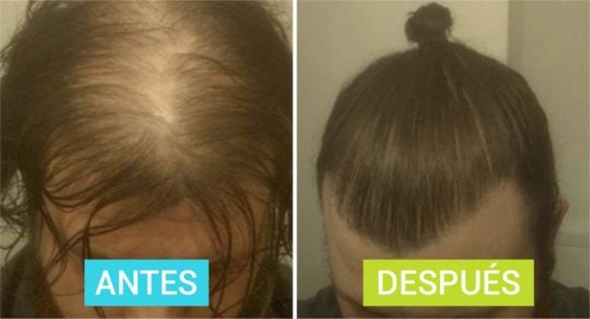Este peinado está muy de moda entre los hombres, pero es más peligroso de lo que crees