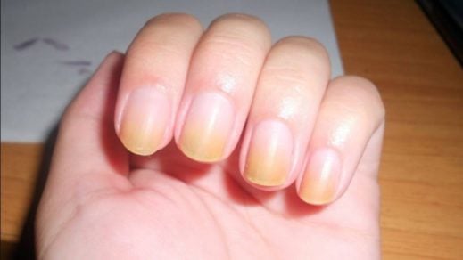 Biodescodificación: Distintas señales en las uñas que indican que tienes un problema