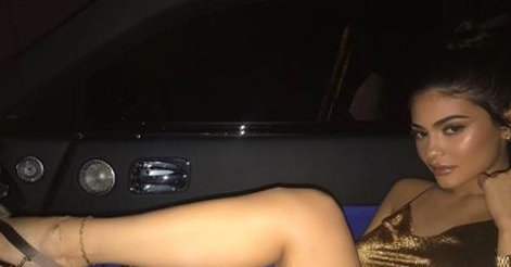 Kylie Jenner alza su pierna y deja ver algo que para muchos es un error. Ella no se avergüenza