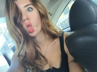 Nació con una curiosa anomalía que la convirtió en una popular modelo