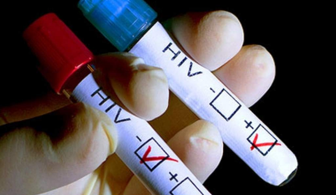 Chile lidera aumento de nuevos casos de VIH en América Latina