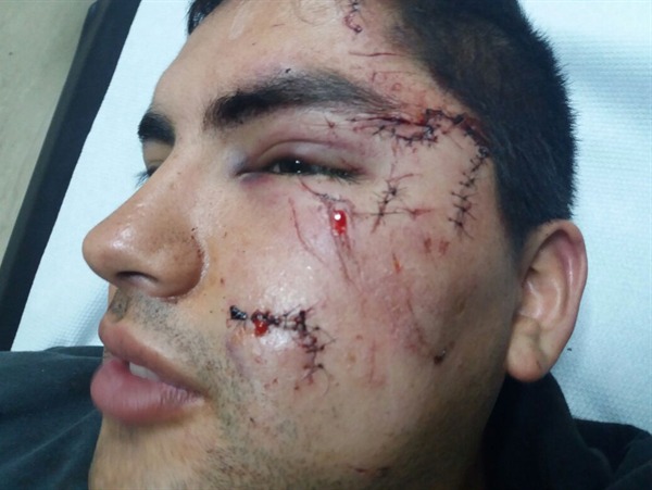 Quintero: Oficial FACH agrede a una mujer y golpea con una jarra de cerveza a cabo que la defendió