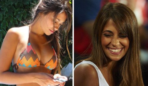 Las fotos que probarían que Antonela Roccuzzo se ha sometido a cirugías