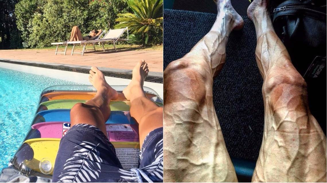 Impresionante: Pawel Poljánski muestra con una foto de sus piernas el sufrimiento de los ciclistas en el Tour