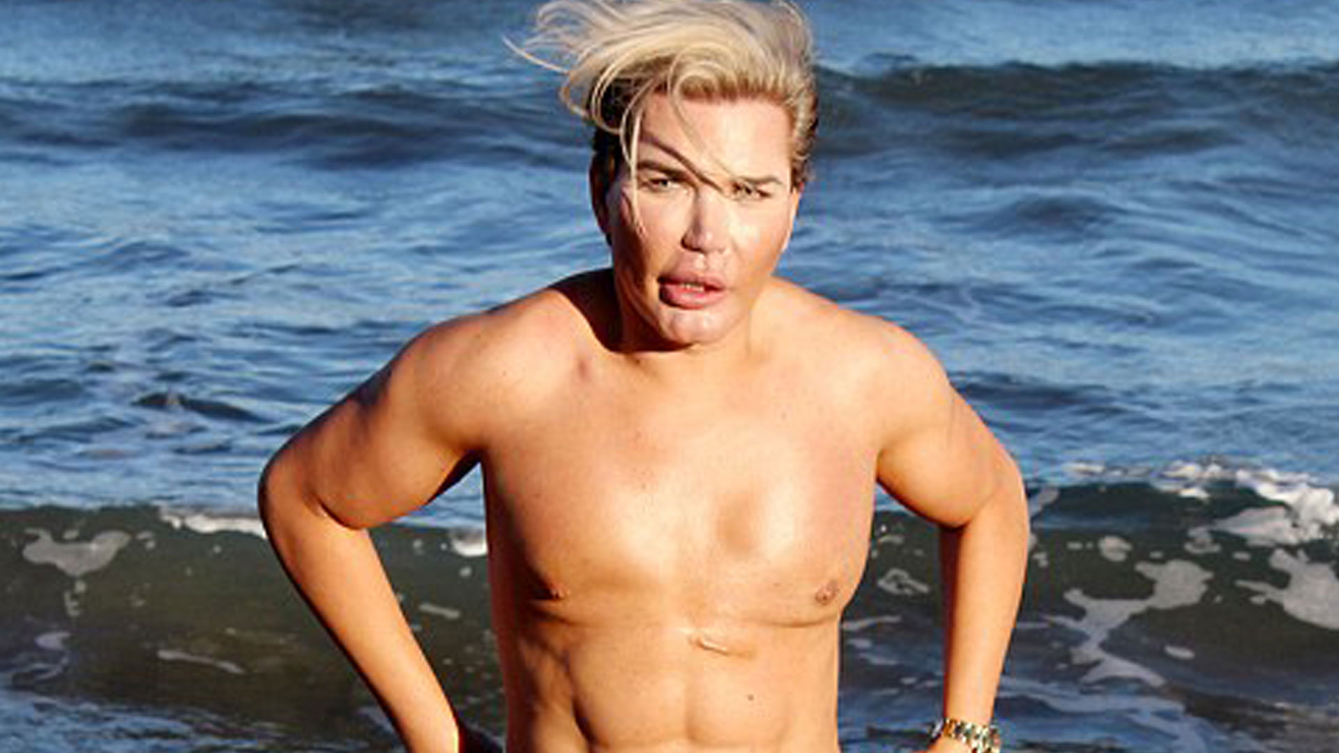 Así lucía Rodrigo Alves, más conocido como «el Ken Humano», antes de sus operaciones