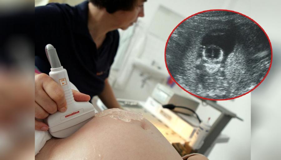 Israel: muere feto infectado con covid-19 en el útero de una mujer