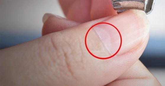 ¿Sabes lo que significa la ‘media luna’ en tus uñas? Esto es lo que muestra sobre tu salud