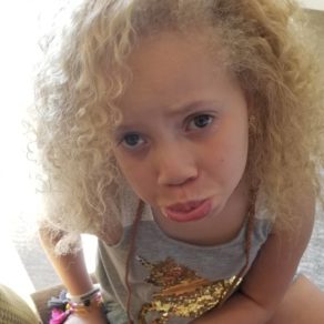 (Fotos) Conoce a la pequeña albina negra que tiene al mundo de la moda completamente revolucionado