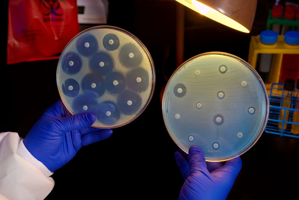 Nanopartículas podrían combatir bacterias resistentes a los antibióticos